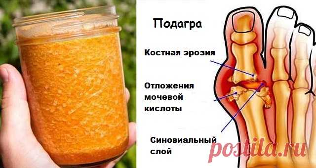Артрит и подагра боятся этого средства как огня! — Домашний уют