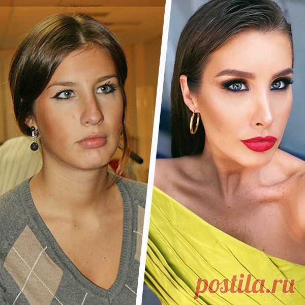 Звезды, которые избавились от комков Биша: зря или нет - Я Покупаю