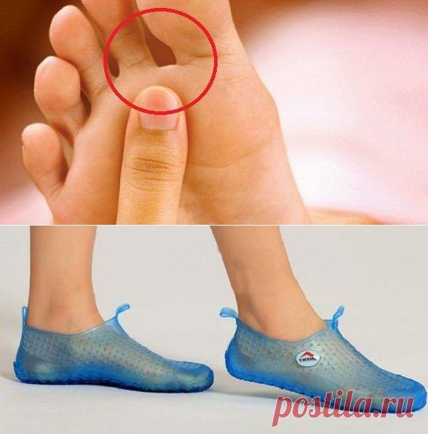 Как избежать заражения грибком стопы / Будьте здоровы