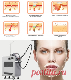 Удаление волос: интимная лазерная эпиляция