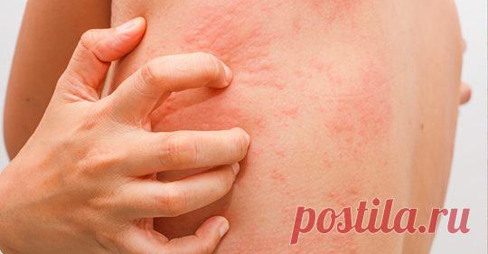 10 признаков того, у вас может быть дефицит цинка Цинк – неимоверно важный компонент, который поддерживает здоровье нашего тела. Этот минерал ответствен за многие системы тела, поэтому недостаток этого мощного питательного вещества может иметь дискре…