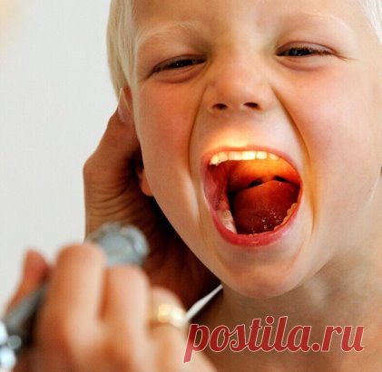 Скорая помощь при ангине
Этот способ лечения ангины я узнала от одного замечательного доктора с большим стажем работы. Рецепт для меня стал просто спасительным, теперь голо лечу только так.
Смешиваю по 2 ч.л. ротокана (продается в аптеке. Это смесь настоек ромашки, тысячелистника и календулы), касторового масла и раствора люголя.
Наматываю на указательный палец бинт, смачиваю его в этом составе и бесстрашно смазываю горло сначала с одной стороны, затем - с другой. Готовить смесь нужно непосре