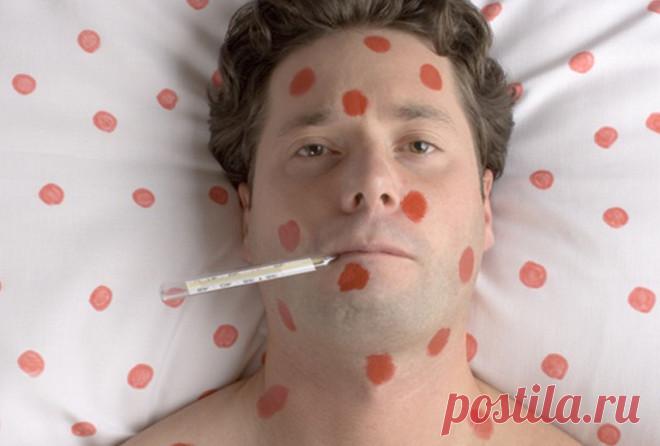 6 детских болезней, крайне опасных для взрослых Существует ряд заболеваний, которыми лучше переболеть в детстве. Будучи взрослыми, люди хуже переносят эти болезни, неожиданно могут начаться осложнения. Если вы еще не болели чем-то из нашего списка,…