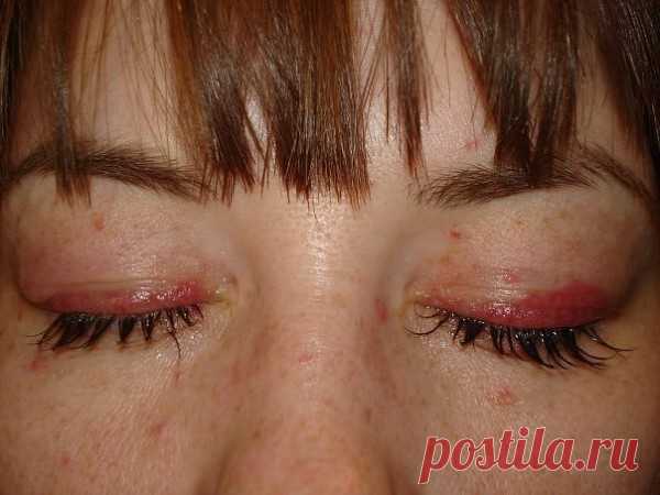 Вред нарощенных ресниц (60 фото) и польза: видео-инструкция по уходу своими руками, фото и цена