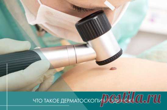 Что такое дерматоскопия родинок?
Дерматоскопия — это один из самых информативных способов диагностики, который применяют для исследования родинок и родимых пятен. Его используют дерматологи, если подозревают злокачественный характер родинки. Особенно, если она появилась у человека недавно. 
Это простой и безопасный для человека метод исследования. Врач наносит на подозрительный участок немного масла и затем рассматривает его с помощью специального устройства — дерматоскопа...