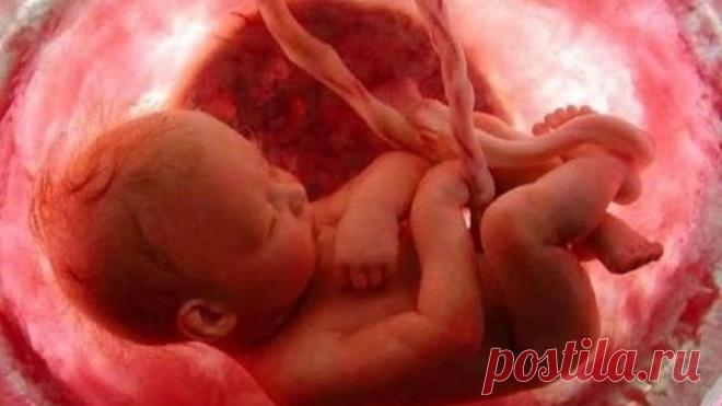 Русский крест или правда об абортах