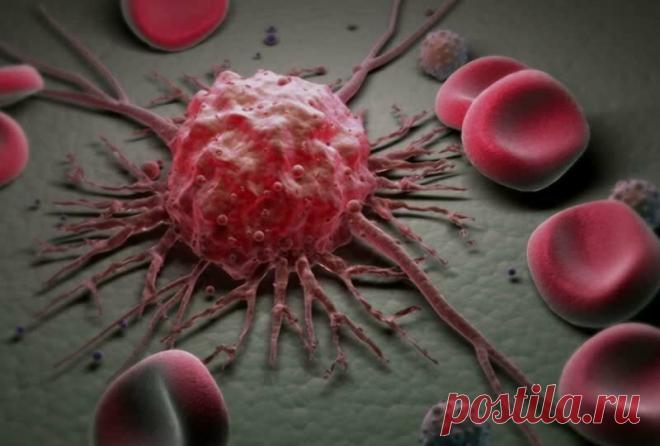 Рак: что делать, когда первичная локализация опухоли неизвестна?
Со злокачественными новообразованиями нередки ситуации, когда локализация первичной опухоли неизвестна. То есть она может быть где и на каком угодно органе и заявлять о себе только метастатическими очагами. Причем «материнское» образование не удается выявить ни обследованием, ни сбором анамнеза. Пациенты с такой клинической картиной...
Читай пост далее на сайте. Жми ⏫ссылку выше