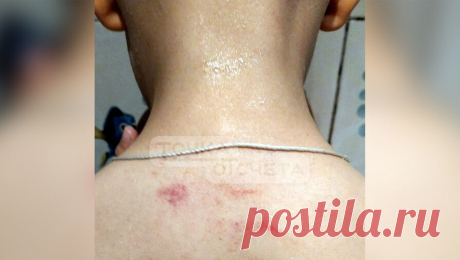 На российского воспитателя, ударившего ребенка, возбудили уголовное дело. В Южно-Сахалинске в отношении воспитательницы, которую мать детсадовца обвинила в избиении ребенка, возбуждено уголовное дело. Об этом сообщили в пресс-службе Следственного управления СК РФ по Сахалинской области. Дело возбуждено по ...