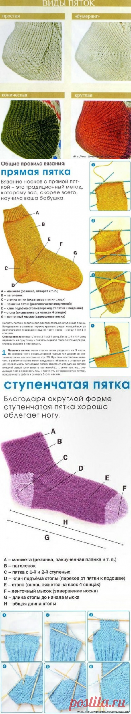 Виды пяток