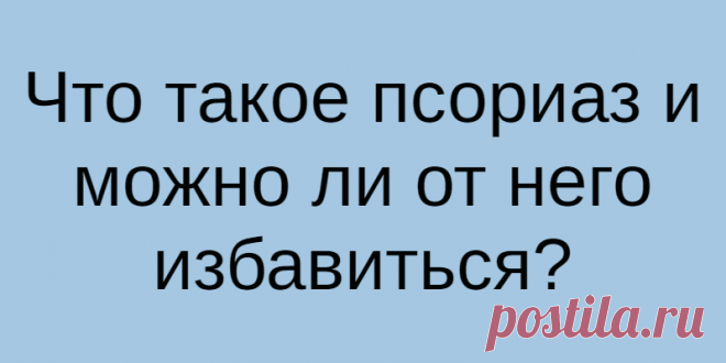 Что такое псориаз и можно ли от него избавиться?
Псориаз называют «чешуйчатым лишаем» по одному из симптомов: определенный участок кожи становится...
Читай дальше на сайте. Жми подробнее ➡