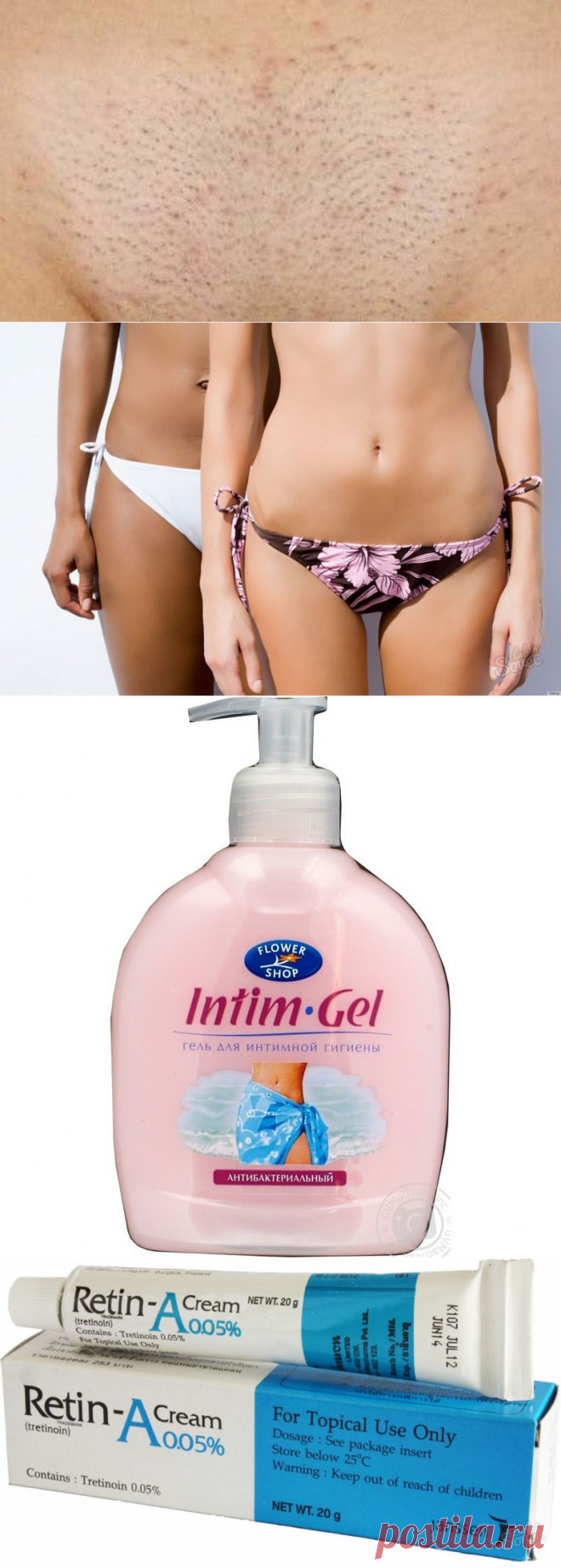 Раздражение на лобке после бритья: советы и рекомендации