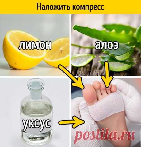 Как легко избавиться от мозоли