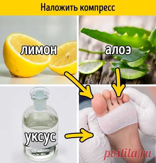 Как легко избавиться от мозоли