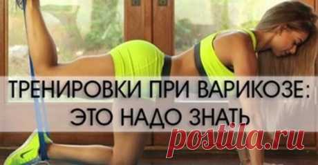 8 упражнений против варикоза — Бабушкины секреты
