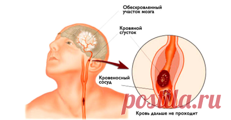 Сперва короткая история: Во время отдыха на природе, молодая девушка вдруг резко остановилась и свалилась на землю. Отдыхающие хотели оказать помощь, но он