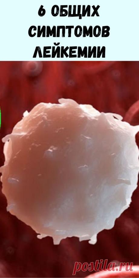 6 общих симптомов лейкемии - Журнал для женщин