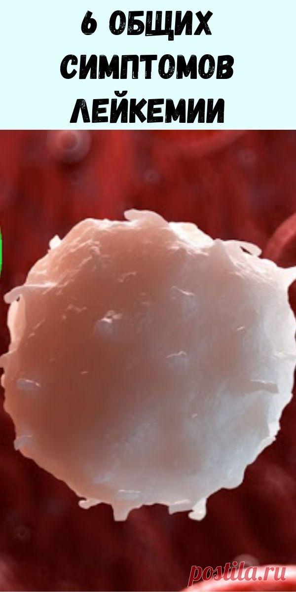 6 общих симптомов лейкемии - Журнал для женщин