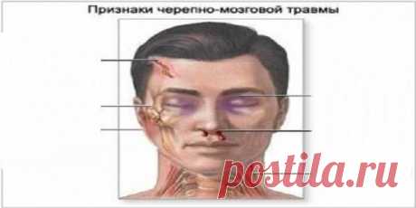 Первая помощь при потере сознания и травме головы. Если хотя-бы кто-то запомнит эту несложную информацию, мы сможем спасти жизни некоторым людям | Узнал сам - расскажи другому.