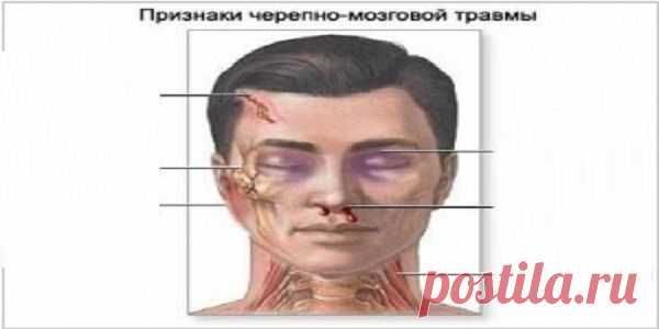 Первая помощь при потере сознания и травме головы. Если хотя-бы кто-то запомнит эту несложную информацию, мы сможем спасти жизни некоторым людям | Узнал сам - расскажи другому.