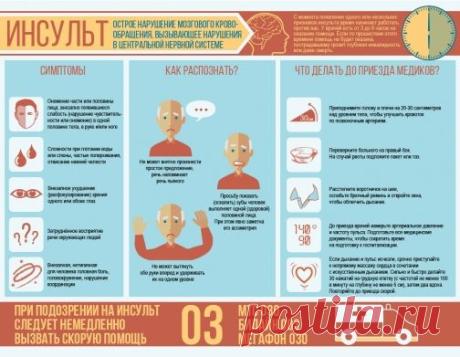 Инсульт: как распознать и что делать при сосудистой катастрофе