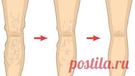 Кокосовое масло может заставить вас выглядеть на 10 лет моложе. Применяйте его в течение 2 недель таким методом!