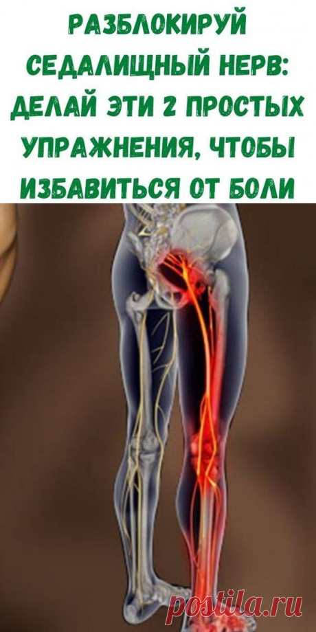 Разблокируй седалищный нерв: делай эти 2 простых упражнения, чтобы избавиться от боли