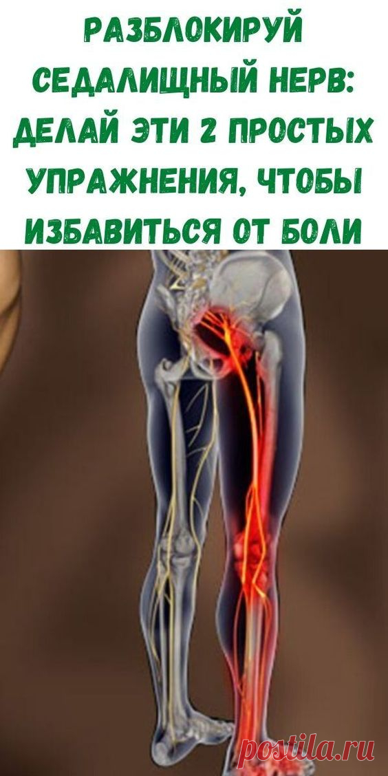 Разблокируй седалищный нерв: делай эти 2 простых упражнения, чтобы избавиться от боли