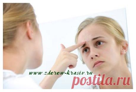 Избавиться от прыщей в короткий срок | Здоровье. Красота. Гармония.
