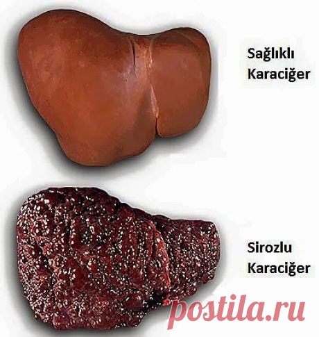Печень спасут травы | Друг пенсионера
В детстве я переболел гепатитом, и уже во взрослой жизни болезнь снова дала о себе знать. Вот как это случилось. Я сидел за рабочим столом. Как сейчас помню: это было утро понедельника.