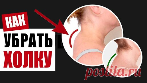 Как избавиться от холки при помощи упражнений | Здоровьесберегающий канал | Дзен