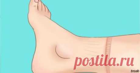 15 тревожных симптомов, что ваше сердце работает не так как надо
Обратите на них внимание!
Проблемы с сердцем по началу незаметны. Сердечно-сосудистые заболевания могут проявить себя совершенно неожиданно. Об этом заявляют ученые из Института сердца и сосудов шта…