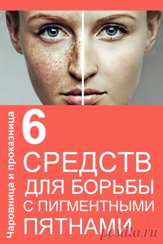 6 чудодейственных средств для борьбы с пигментными пятнами | Чаровница и проказница