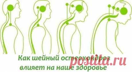 БОЛИТ ШЕЯ? КАК ШЕЙНЫЙ ОСТЕОХОНДРОЗ ВЛИЯЕТ НА НАШЕ СОСТОЯНИЕ.