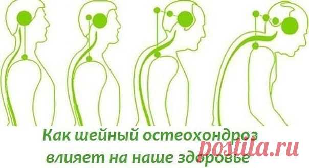 БОЛИТ ШЕЯ? КАК ШЕЙНЫЙ ОСТЕОХОНДРОЗ ВЛИЯЕТ НА НАШЕ СОСТОЯНИЕ.