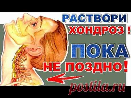 Как излечить шейный остеохондроз навсегда. Топ рецепт для шеи.