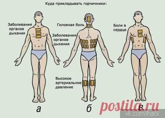 Куда прикладывать горчичники | Мамам, женщинам, бабушкам и очень любознательным.