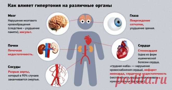 Гипертония: симптомы, степени, лечение и профилактика
