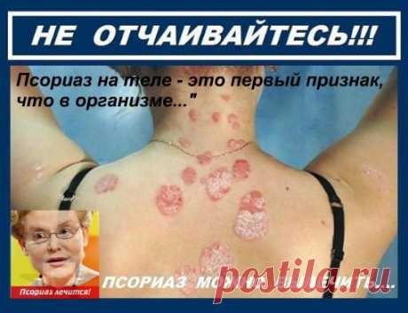 Девчонки.я вечно ходила с закрытой спиной.Теперь могу покрасоваться в открытых нарядах.Я снова счастлива.У меня чистая и гладкая кожа.Мне помогло и вам поможет.