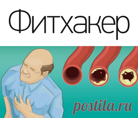 Эти продукты прочистят артерии и защитят от сердечного приступа. Ешь их больше – живи дольше!