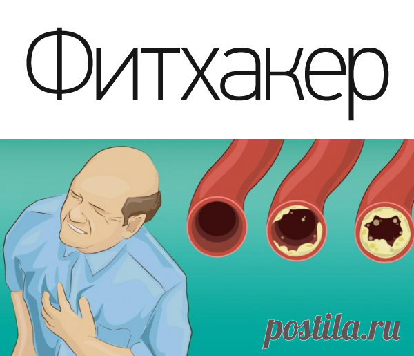 Эти продукты прочистят артерии и защитят от сердечного приступа. Ешь их больше – живи дольше!