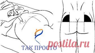 Правильный укол - что это такое?

Вместо того, чтобы лечить последствия неграмотно сделанных инъекций, лучше делать все правильно!

На что нужно обращать внимание, когда вам вводят лекарственные препараты:

* Инъекцию должны проводить медленно, чтобы раствор равномерно и правильно распределился по месту укола. 

* При самой процедуре не должны совершаться рывки; поршень двигается плавно, без каких-либо усилий. 

* Вы должны чувствовать спокойствие перед и при самом процесс...