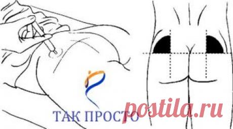 Правильный укол - что это такое?

Вместо того, чтобы лечить последствия неграмотно сделанных инъекций, лучше делать все правильно!

На что нужно обращать внимание, когда вам вводят лекарственные препараты:

* Инъекцию должны проводить медленно, чтобы раствор равномерно и правильно распределился по месту укола. 

* При самой процедуре не должны совершаться рывки; поршень двигается плавно, без каких-либо усилий. 

* Вы должны чувствовать спокойствие перед и при самом процесс...