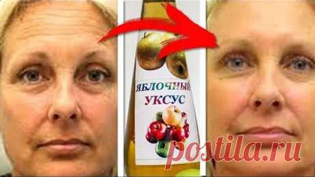 Нанесла ЯБЛОЧНЫЙ УКСУС на ЛИЦО... Такого ЭФФЕКТА Я Не Ожидала...!!!