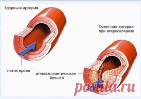 Крупнейшая афера ХХ века / Научный хит