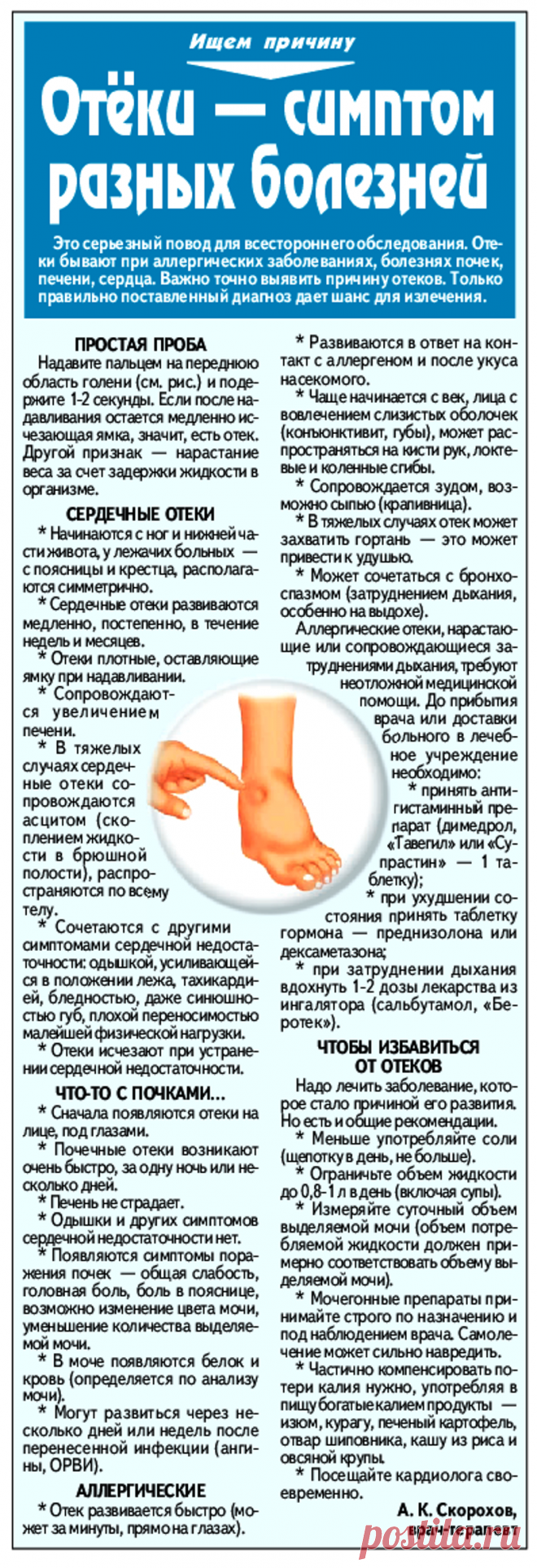 Отеки - симптом разных болезней