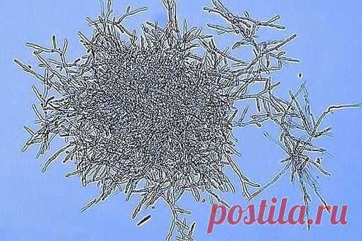 Поиск новостей по запросу Гриб-слизевик в человеке