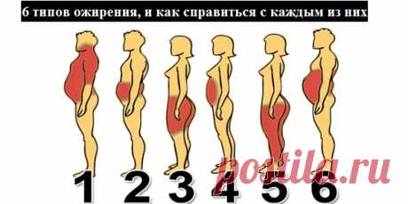 6 ТИПОВ ОЖИРЕНИЯ, И КАК СПРАВИТЬСЯ С КАЖДЫМ ИЗ НИХ