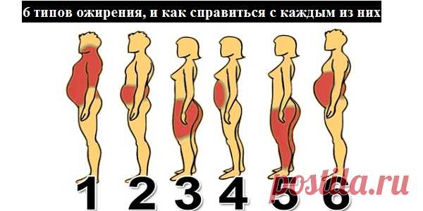 6 ТИПОВ ОЖИРЕНИЯ, И КАК СПРАВИТЬСЯ С КАЖДЫМ ИЗ НИХ