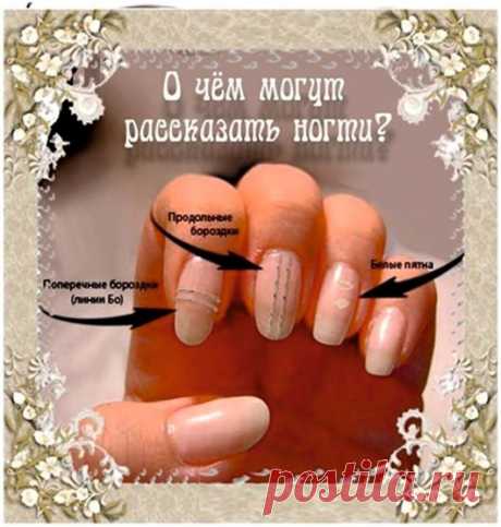 О чем говорят наши ногти • Длинные линии на ногтях указывают на плохую всасываемость пищи в системе пищеварения. • Поперечные желобки на ногтях указывают на плохое питание или на запущенные болезни. • Иногда ногти бывают выступающими, выпуклыми, луковицеобразными, похожими на барабанные палочки...