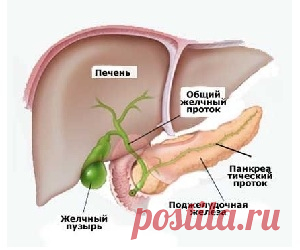 Холецистит.